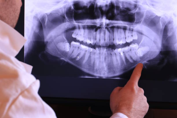 Best Broken or Cracked Tooth Emergency Dentist in Shawnee, KS
